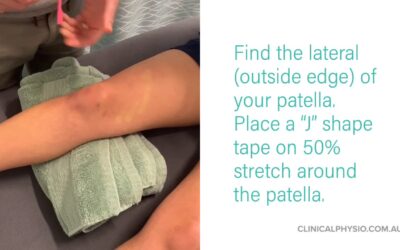 The Best and Easiest Patella Taping
