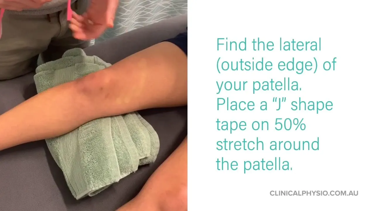 Clinical Physiotherapy St Ives The Best and Easiest Patella Taping