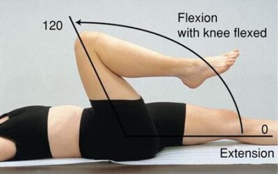 Hip Osteoarthritis Treatment: Understanding the Condition and Physio vs Surgery